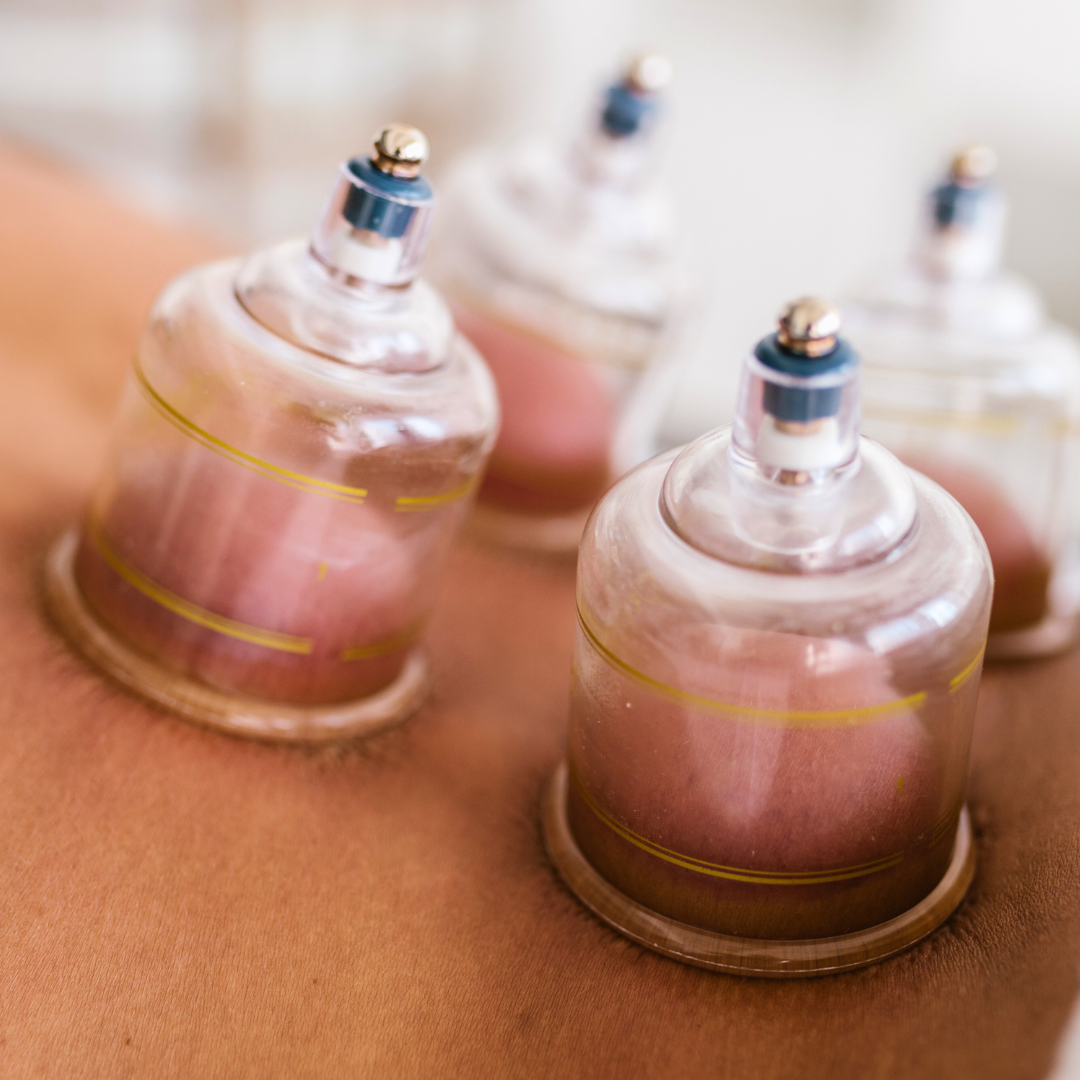 30- Minute Hijamah Renewal (Wet Cupping) | Affordable Monthly Clinic Program